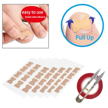 

NEW Double-sided tape Ingrown Toenail Correction Tool Set Nail Pedicure Elastic Patch Straightening Clip Brace Bunion Corrector