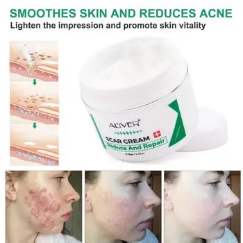 

Scar Removal Cream Acne Treatment Repairing Scar Body Slimming Cream Whitening Moisturizing Skin Care 97g TSLM1