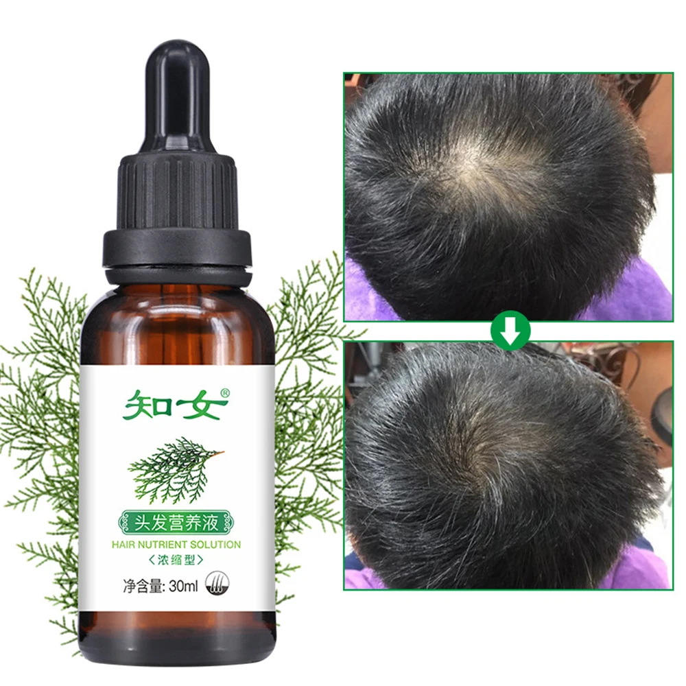 

30ml Fast Hair Growth Serum Essential Oil Anti Hair Loss Treatment Help for Hair Growth Nourish Roots For Men Hair Care TSLM2