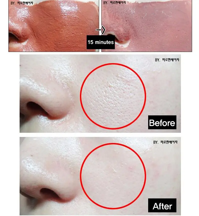TOSOWOONG Platinum Miracle для сужения пор упаковка 150 г маска для удаления черных точек лица глубокое очищение угрей, уход очищение пор