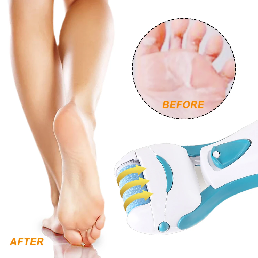 Battery Hard Dry Skin Callus Remover Spin Roller File Feet Foot Care Pedicure Foot Care Tool Aliexpress