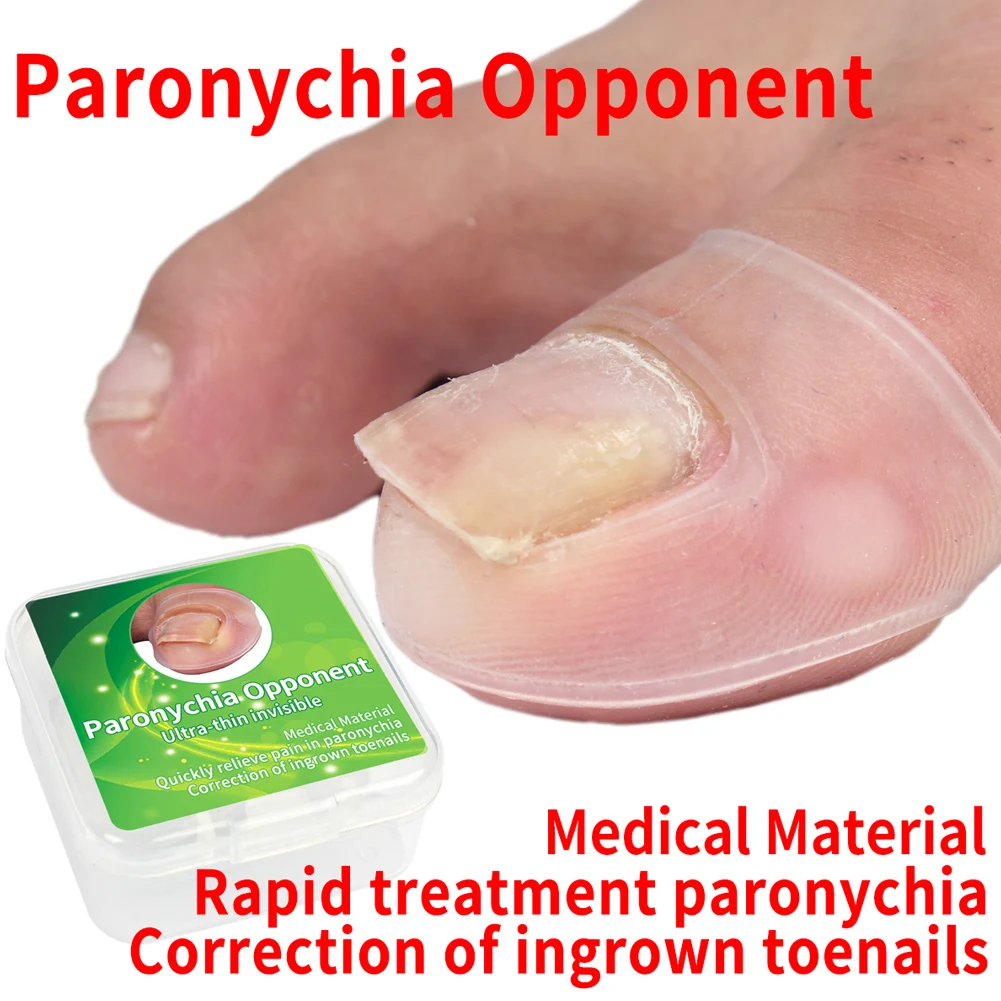 2pcs Silicone Ingrown Toenail Correcting Tool Pain Relief Paronychia Treatment Corrector Invisible Silicone Inlay Corrector Care