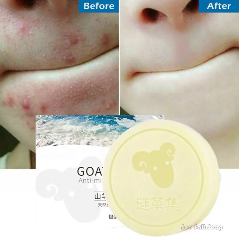 

90g Sea Salt Soap Removal Pimple Pores Acne Treatment Natural Goat Milk Soap Face Moisturizing Skin Care Wash Clean Basis Soap