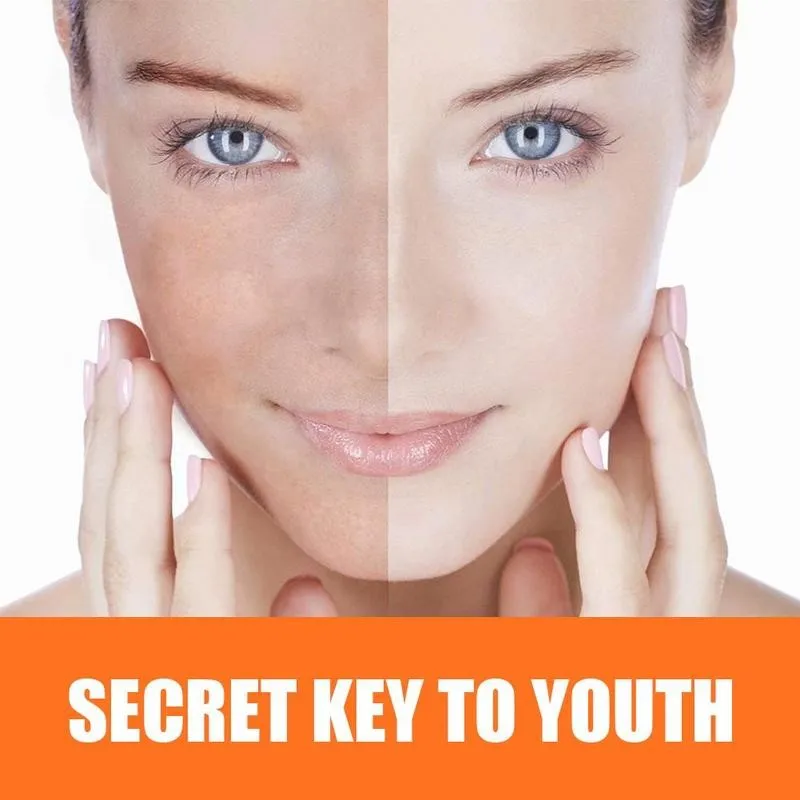 15ml Instant Blemish Removal Gel Vitamin C Whitening Anti Freckle Cream Pen Effective Remove the Freckle Pigmented Melanin Spots 15ml Instant Blemish Removal Gel Vitamin C Whitening Anti Freckle Cream Pen Effective Remove the Freckle Pigmented Melanin Spots