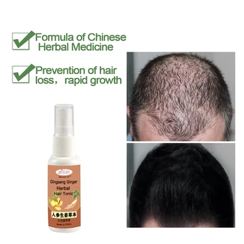 

High Quality Ginseng Ginger Herbal Hair Tonic Nourishing Solution Repairs Hair Follicles Promotes Regrowth