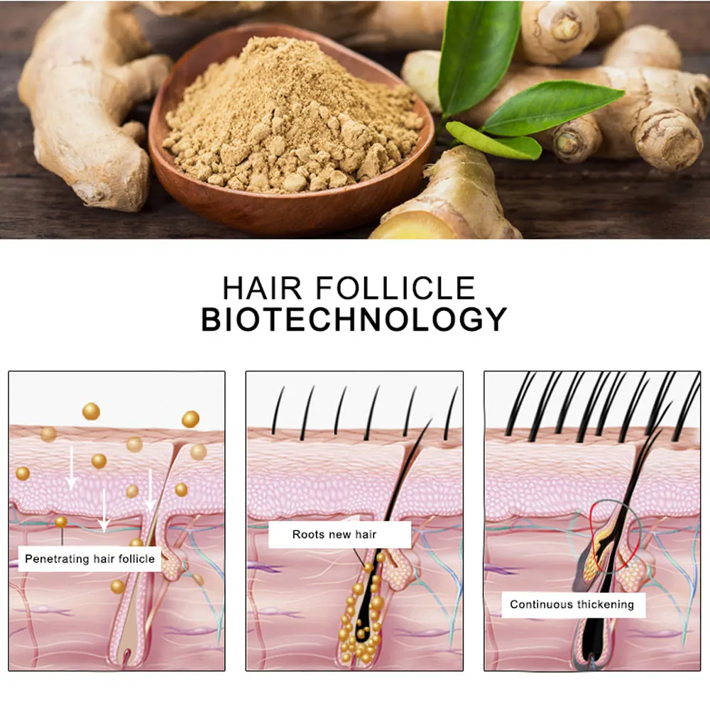 продукты для роса волос. продукты ускоряющие рост волос. что способствует росту волос. корейская косметика для волос от выпадения и для роста волос. что способствует росту волос.