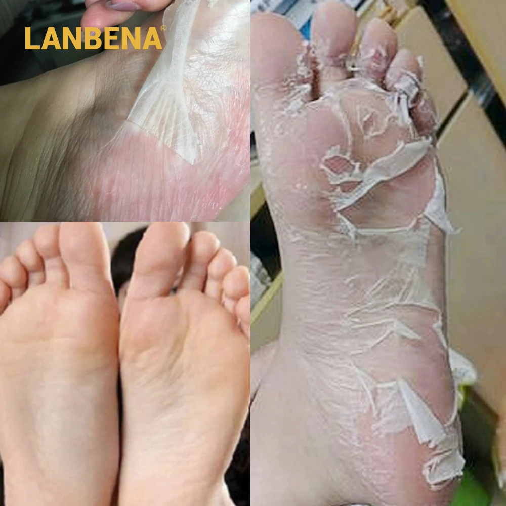 LANBENA 2 шт./пара маска для ног, маска для удаления омертвевшей кожи удаления отбеливающий Уход за ногами, пленка для ног увлажняющий пилинг