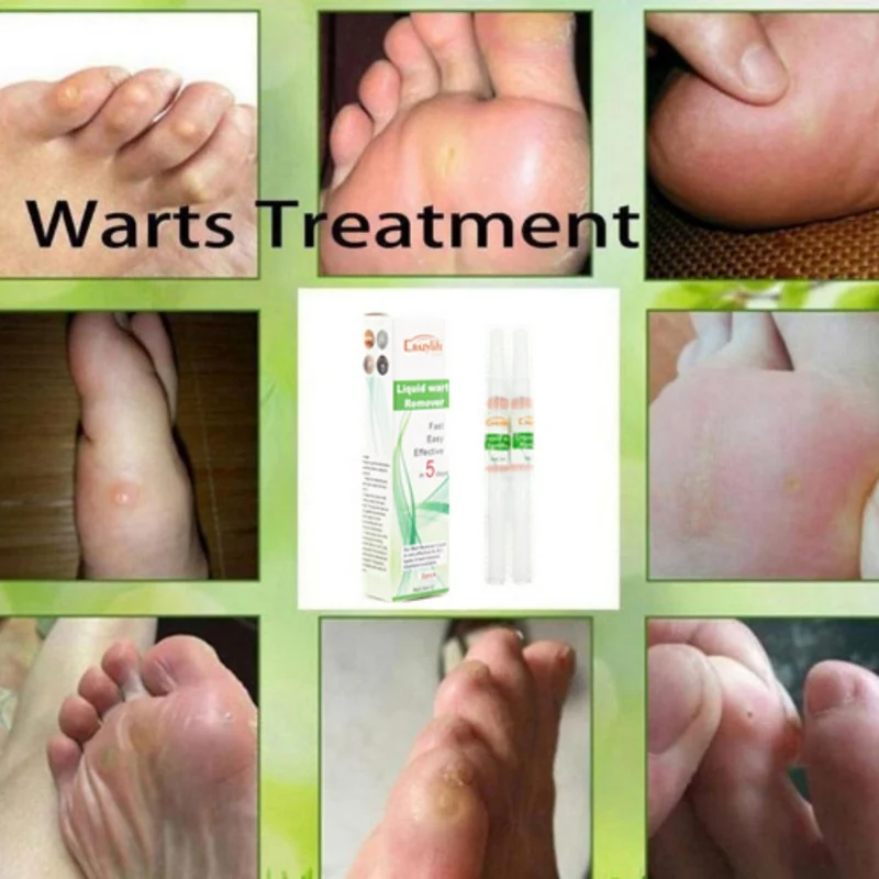 Remove Old Sputum To Remove Dead Skin Pen To Beautify Skin Care CRAZYLIFE