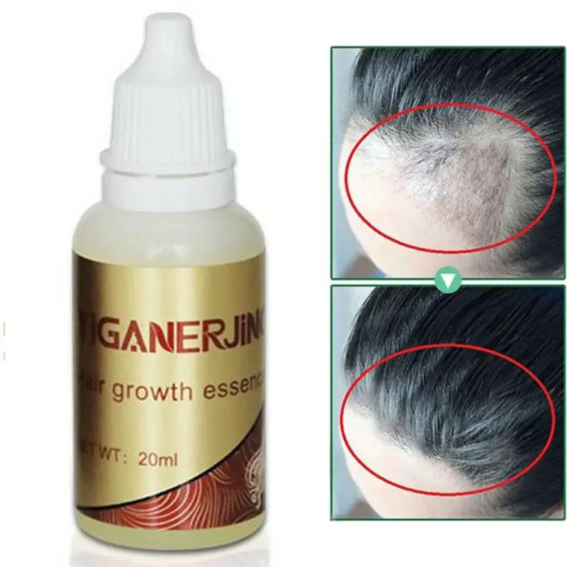 20ml el crecimiento del cabello líquido el crecimiento del cabello aceite SÉRUM Natural Extracto de tratamiento para la pérdida de cabello producto de cuidado del cabello TSLM1