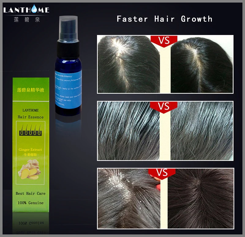 30ml Hair Fast Growth Spray Hair Regrowth Serum