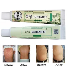 10 шт Zudaifu кожи псориаз мазь дерматит экзема крем для тела экзема псориаз лечение мазь Zudaifu крем