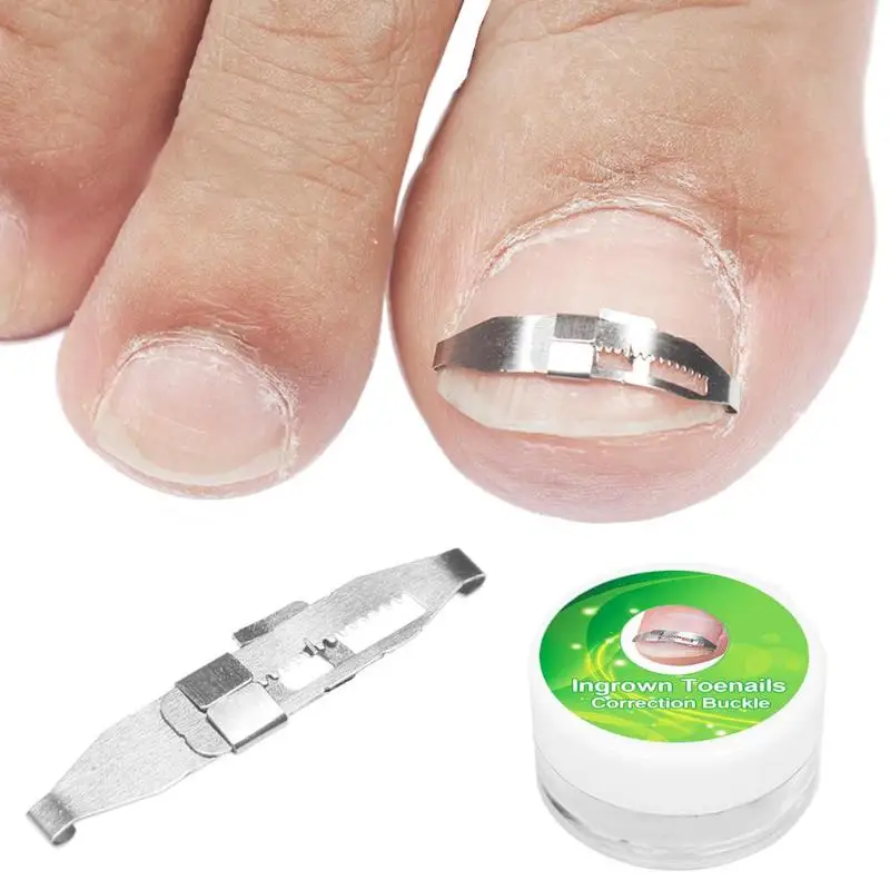 Metal Ingrown Toe Nail Correction Wire Fixer Pedicure Paronychia Recover Toenails Corrector Foot Care Tool