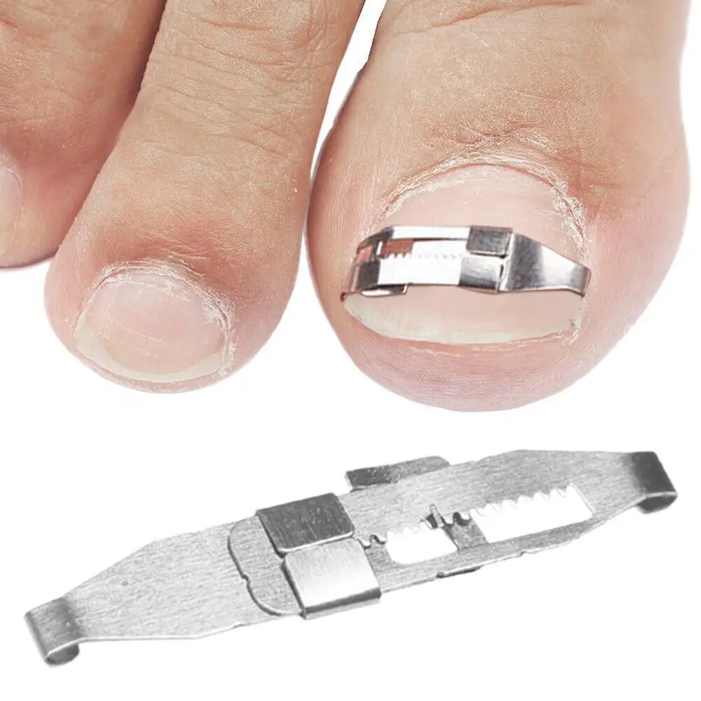 2pcs Ingrown Toe Nail Correction Tool Toenail Straightening Correctors