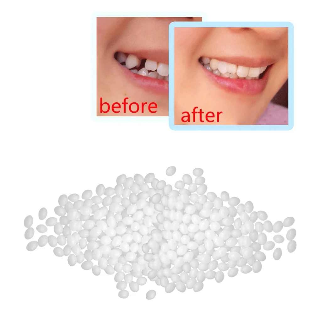 

Teeth Whitening Resin False Teeth Solid Glue Temporary Tooth Repair Set Gap Falseteeth Solid Glue Denture Adhesive Teeth Dentist