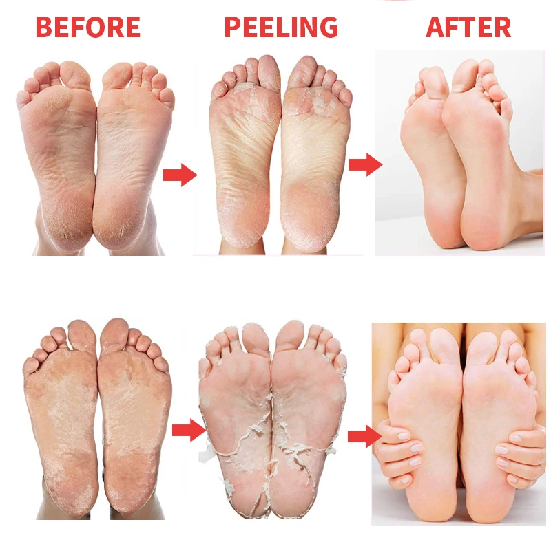4pcs/2pack Peach Foot Mask Moisturizing Foot Patches Exfoliating Foot Masks Peeling Dead Skin Pedicure Socks Smooth Feet Masks