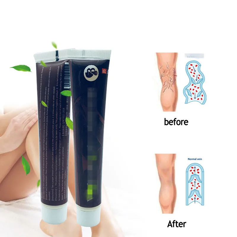 

Cream Effective cure Vasculitis Phlebitis Spider Veins Pain Varicosity Angiitis ointment Health Care