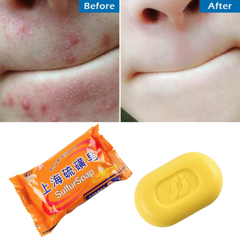 

Shanghai Sulfur Soap Oil Control Acne Treatment Blackhead Remover Soap 85g Whitening Cleanser Chinese Traditional Skin Care