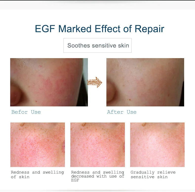 egf_07