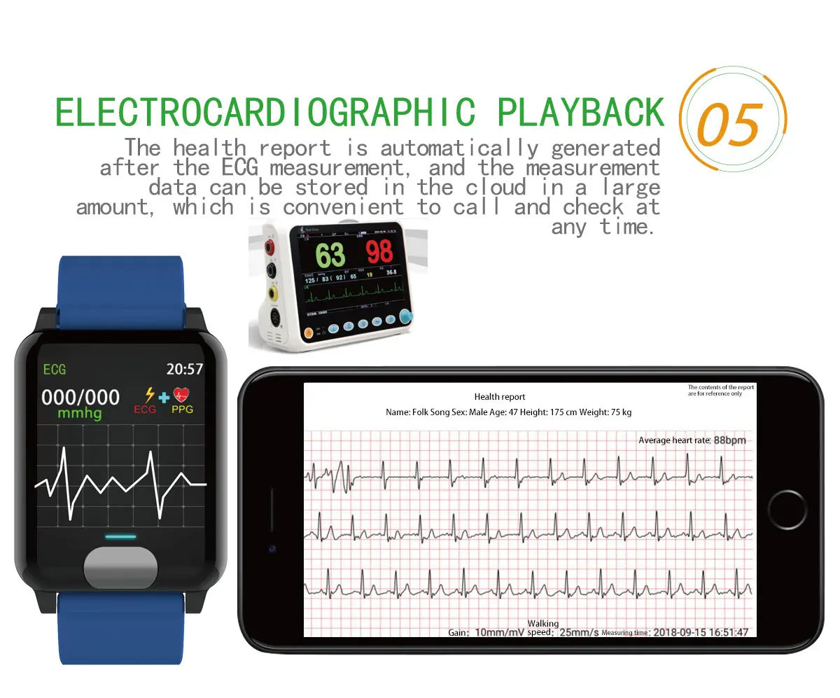 ECG PPG Смарт-часы монитор тонометр танометры для измерения артериального давления с электрокардиограммой дисплей пульса смарт-Браслет фитнес-трекер P67 водонепроницаемый