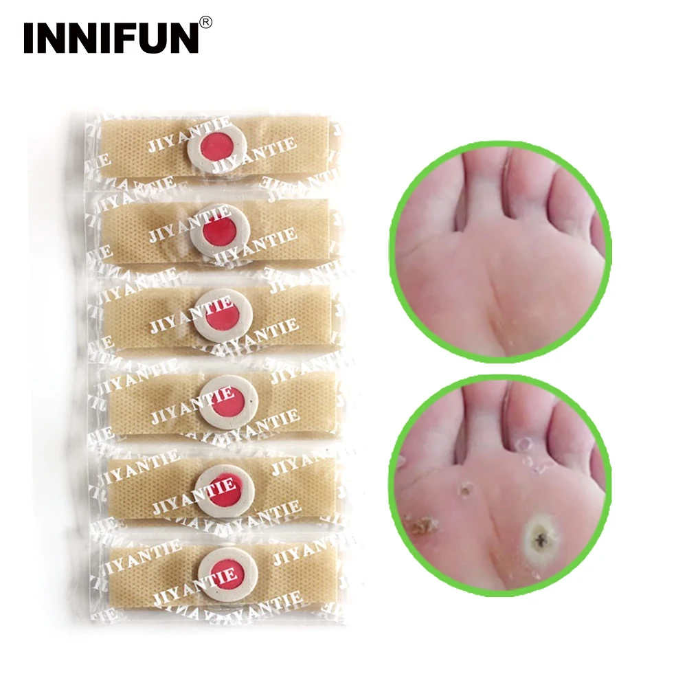 

Painless Foot Corn Removal Plaster Band Aid Watch Your Feet Care Pedicure Tools Profession Callus Remover Pedicore Neat feet