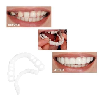 

Cosmetic Dentistry Snap On Smile Instant Smile Comfort Fit Flex Teeth Fits Most Whitening False Teeth Upper Tooth Cover