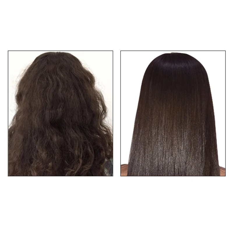 60ml of scalp nutrient solution. Nutritional scalp leave-in essence, anti-hair loss treatment damage, Unisex.