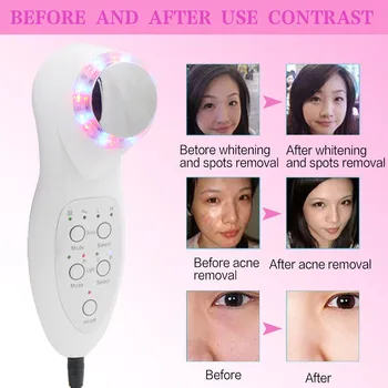 

Mesotherapy Electroporation Face Beauty Pen RF Radio Frequency LED Photon Face Lifting Skin Rejuvenation Anti Wrinkle Massager