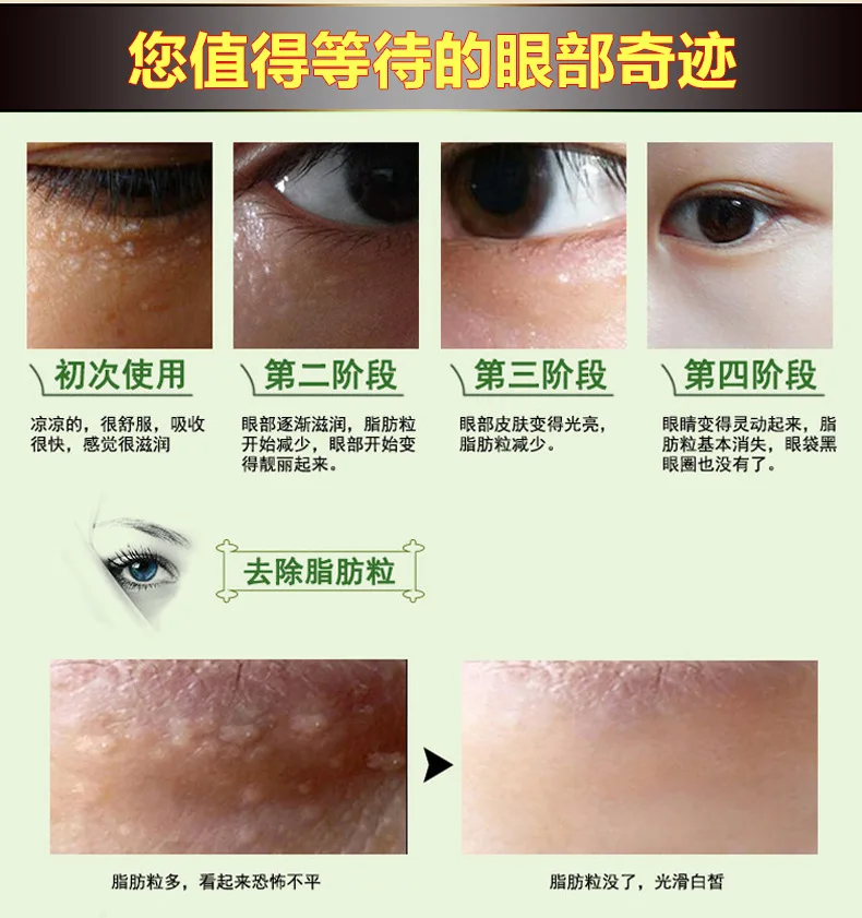 8816887526_737213657