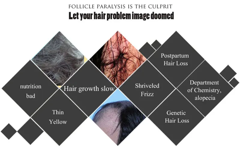 óleo queratina erval rápido crescimento do cabelo