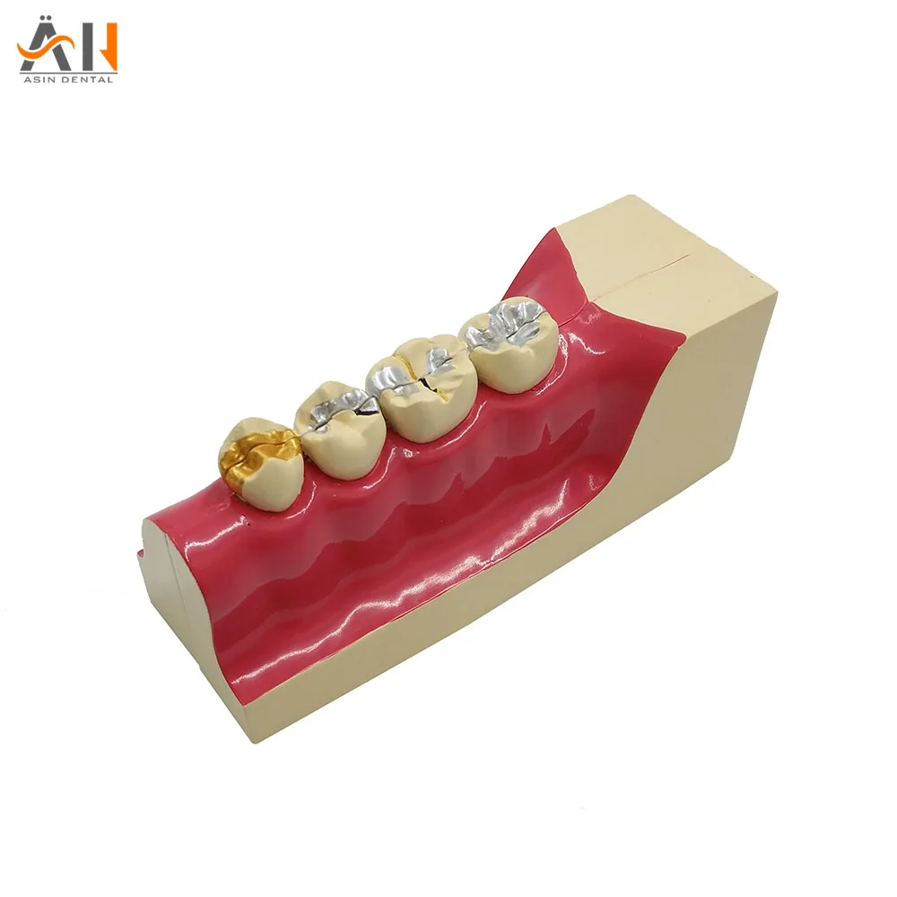

Dental teeth model Lower right posterior teeth tissue decomposition model Doctor - patient communication model with magnetic
