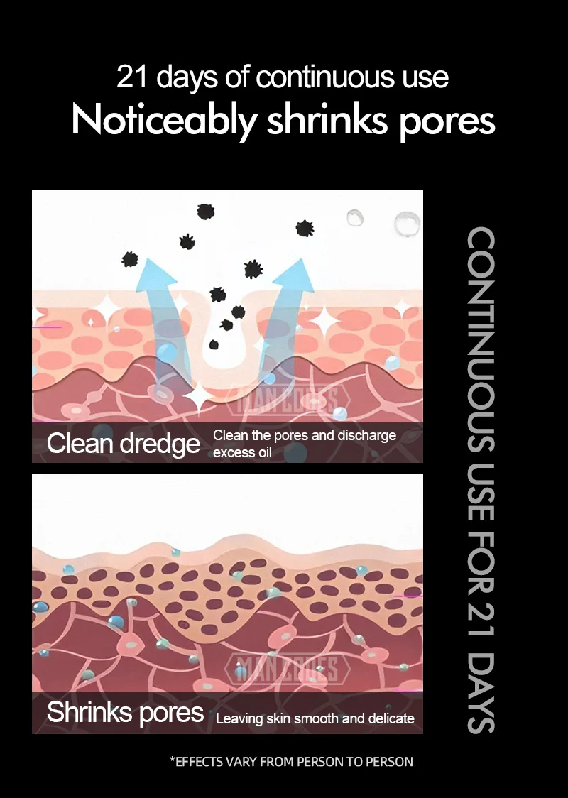 男士乳糖酸精华液详情-水印_05