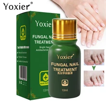 

Fungal Nail Treatment Essence Antibacterial Liquid Repair Discolored Brittle Cracked Gentle Anti Infection Paronychia Nail Care