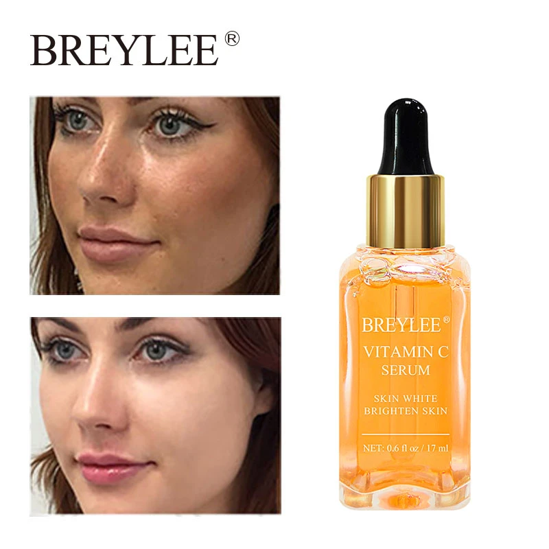 Herbaderm Yuz Icin Renk Acici Leke Kremi