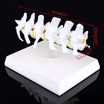 

Dog Canine Lumbar Disc Herniation Model Aid Teaching Anatomy Instruments Study