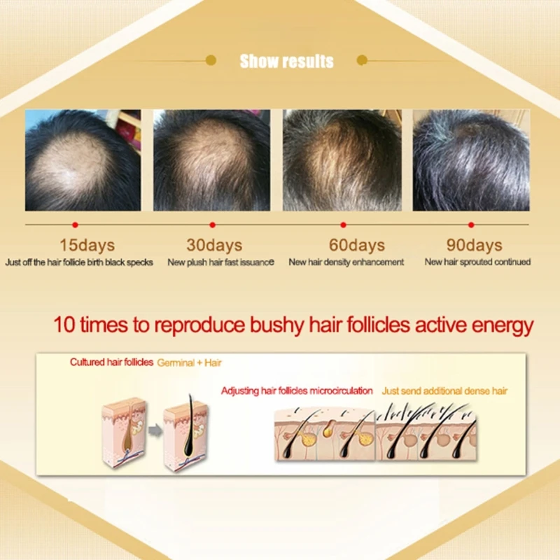 Drop Ship&Wholesale 30ML Shampoo Fast Hair Growth Serum Hair Loss Treatment Fibers Growing-faster Oct.18