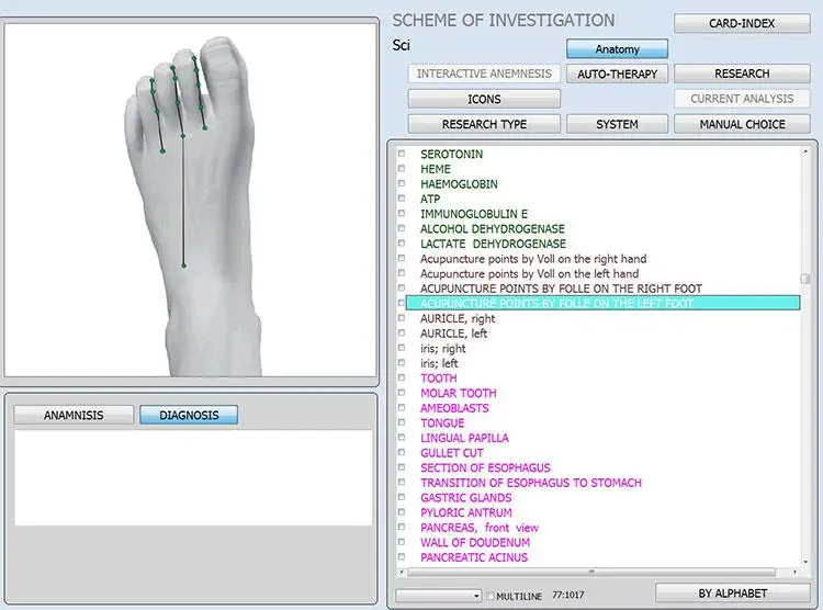 12D 9D CELL NLS AURA CHAKRA IRIS Body Scanner NON-LINEAR Analyzer Resonant English Polish German Japan Portuguese Spanish French 5