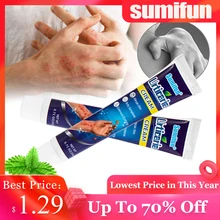 Apenas $1.29 sumifun urticária creme antibacteriano erval pomada dermatite eczema psoríase anti coceira cuidados com a pele gesso médico