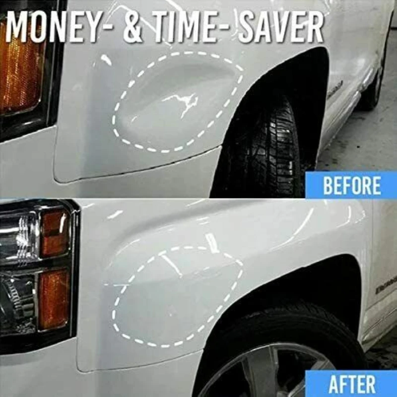 車の修理ツールキット 車のへこみ除去ツール 吸盤 車のへこみ修理ツール Aliexpress