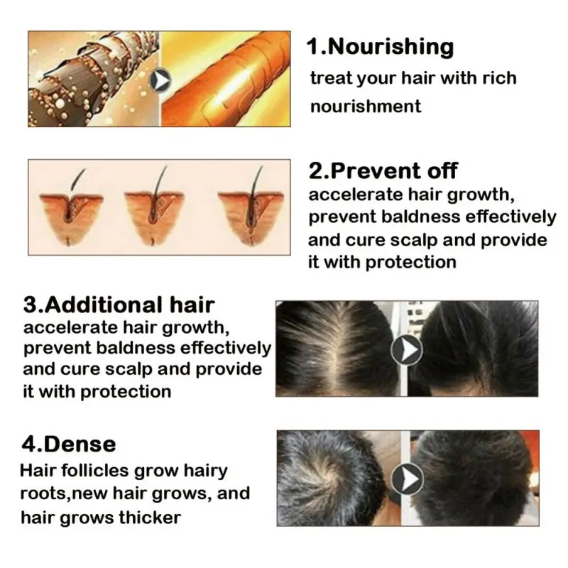 Лечение Сыворотка для волос против выпадения истончение лысение ремонт волосяных луковиц способствует более густым более сильным волосам способствует росту волос