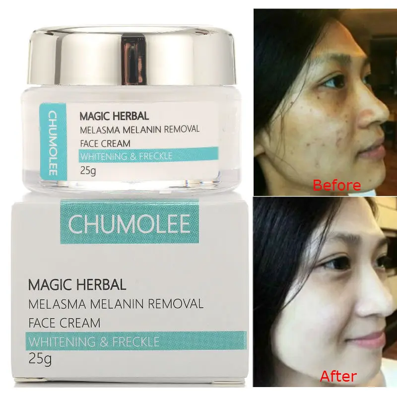 magic herbal cream
