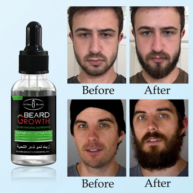 Natural Accelerate Beard Growth Oil Anti Hair Loss Men Beard Growth  Beard Grow Stimulator Facial Hair Grower 2pcs Moustache 2