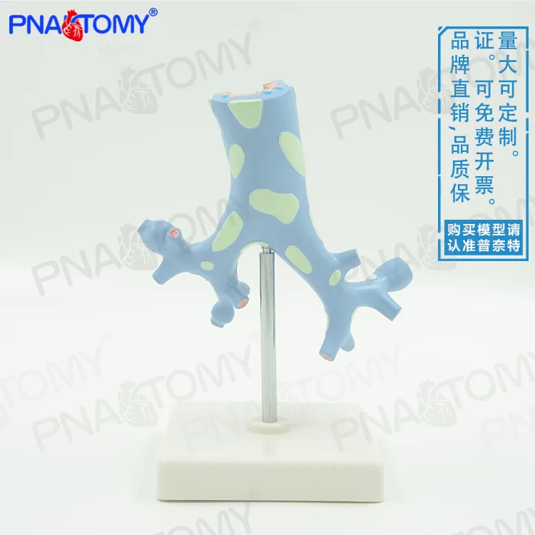 

Human Respiratory Pathology Lung Bronchial Tree Anatomy Model Medical Teaching Respiratory Specimen