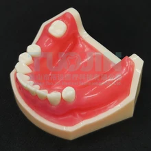  Dental Resin Teeth Tipodont Model For Dental Technician Practice Teaching Gum Teeth Jaw Model Dentistry Training Equipment 