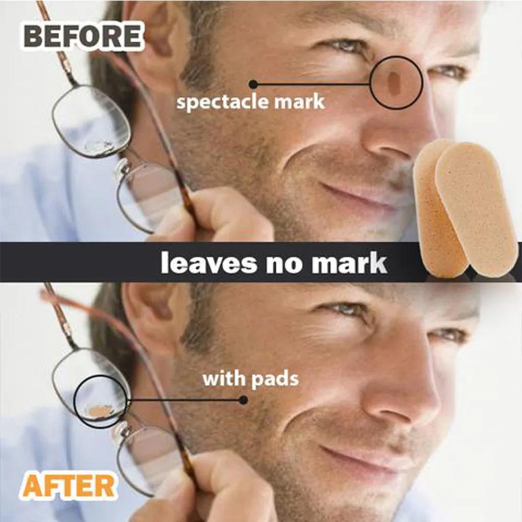 Sunglasses Mark On Nose For Sale Off 77