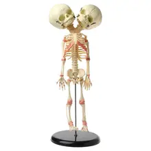 

37cm Human Double Head Baby Skull Skeleton Anatomy Brain Display Study Teaching Anatomical Model