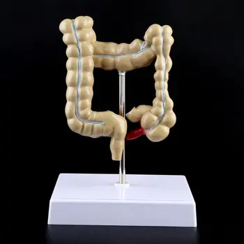 

Human Colorectal Lesion Model Pathological Anatomy Colon Diseases Intestine Medical Teaching Learning Tool D08B