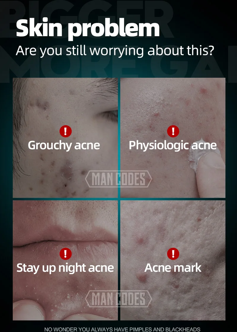 左颜右色祛痘膏-水印_03