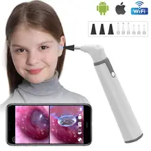 Wifi Ohr Otoskop 3,9mm Smart Drahtlose Tragbare Visuelle Ohrenschmalz Reinigung Medizinische Endoskop Kamera für iPhone Android Telefon iPad