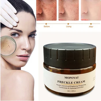 

50g Facial Freckles Removal Cream Moisturizing Lighten Melanin Brighten Skin Color Face Whitening Cream