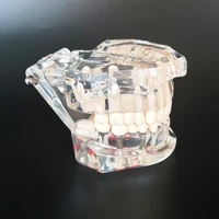 Nowy Model dentystyczny Implant zębów przywrócenie mostu nauczanie studium medycyna nauka choroba dentysta stomatologia produkty 4